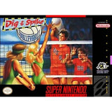 Dig and Spike Volleyball